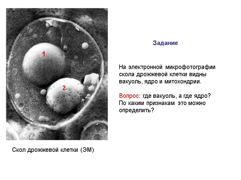 Скол дрожжевой клетки (ЭМ) 1 2 Задание На электронной микрофотографии скола дрожжевой клетки видны